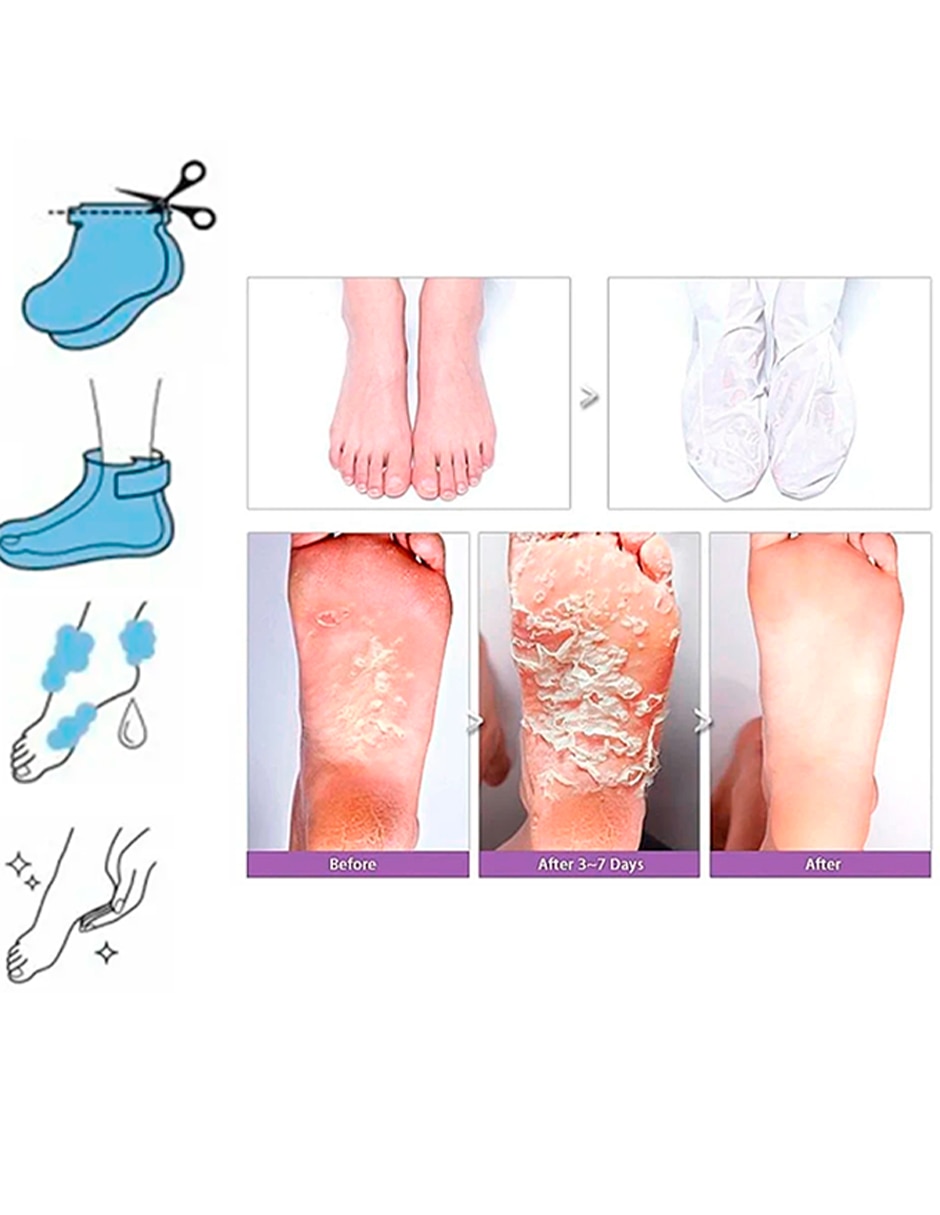 Mascarilla Changing Magic Foot Peeling Shoes para limpiar Changing