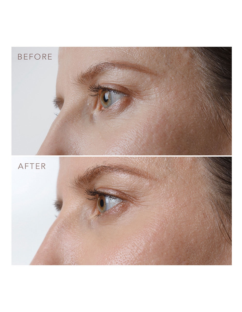Tratamiento para contorno de ojos hidratante Iris 4
