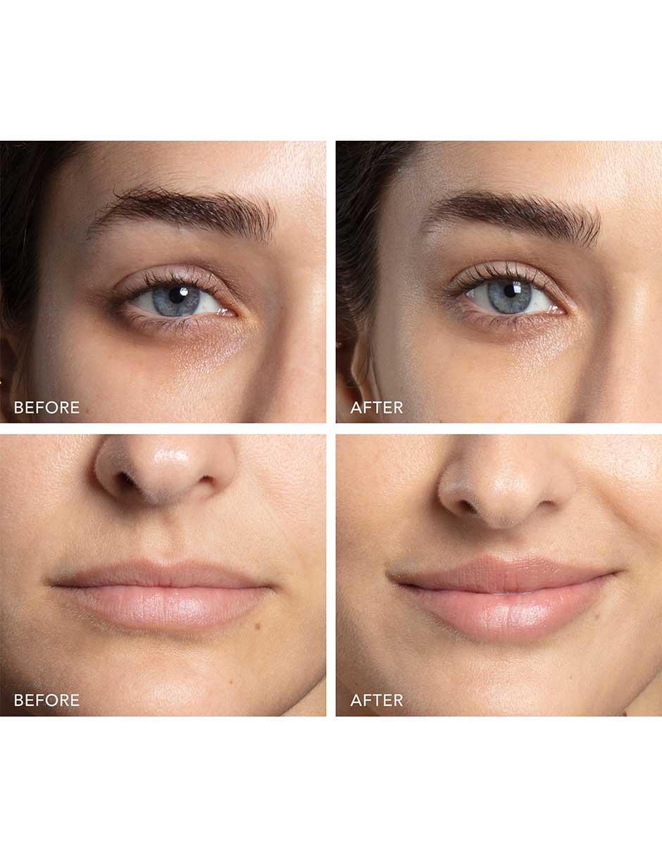 Dispositivo de microcorriente BEAR 2 Eyes & Lips