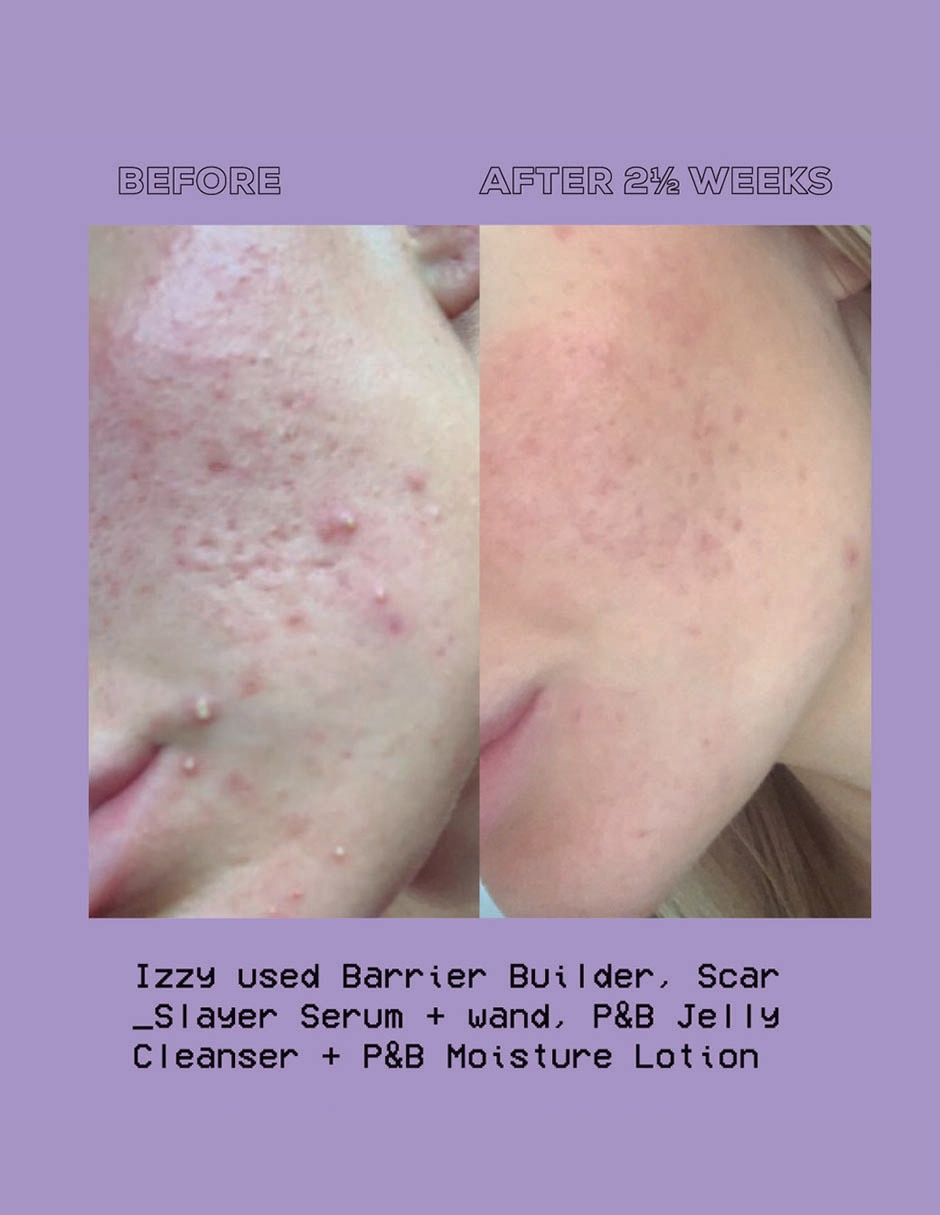 Crema hidratante Purify and Brighten