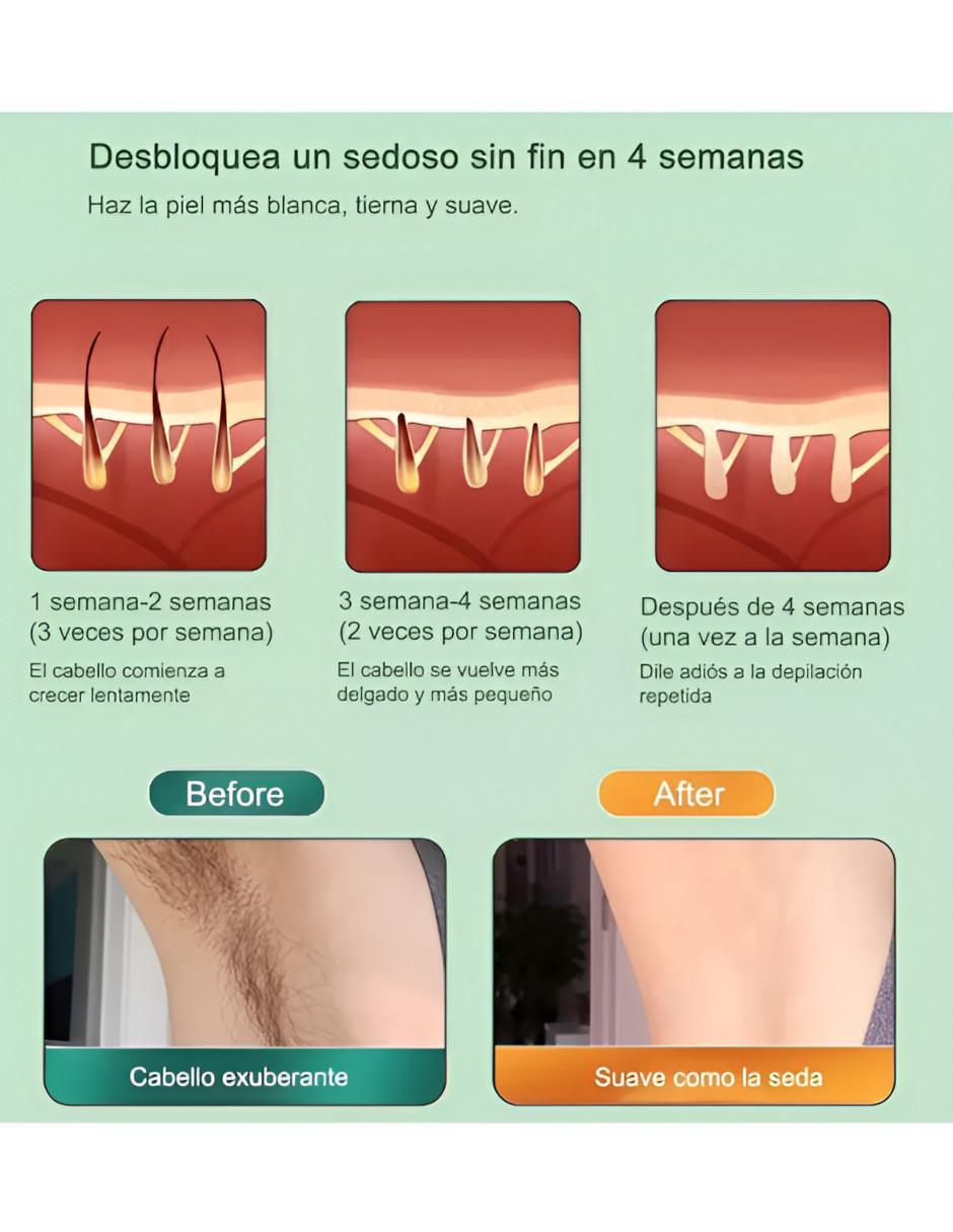 Depiladora IPL para cuerpo