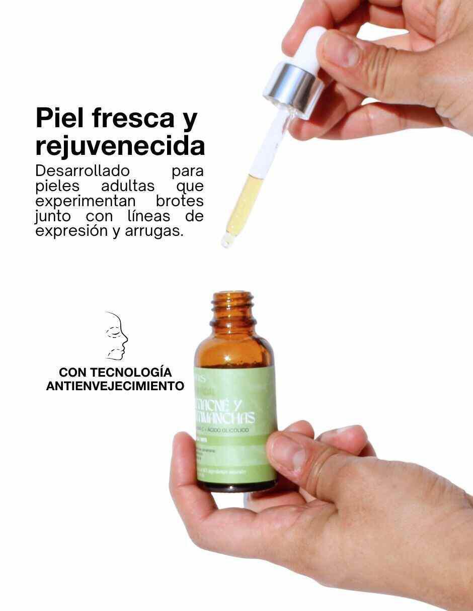 Sérum antiacné facial Antiacné de piel grasa 4