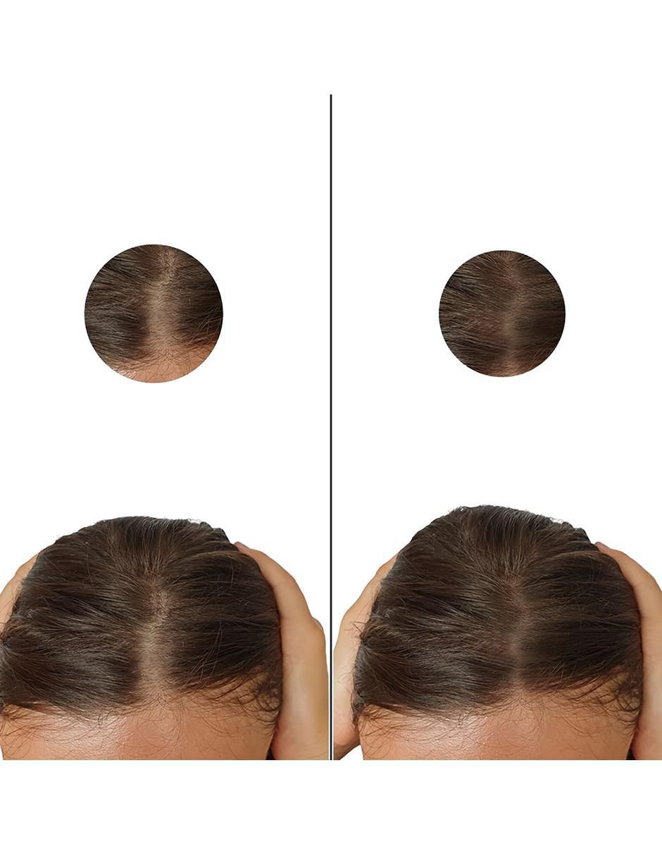 Tratamiento para capilar Dutasterida 0.5Mg anticaída Tratamiento para capilar Dutasterida 0.5Mg anticaída