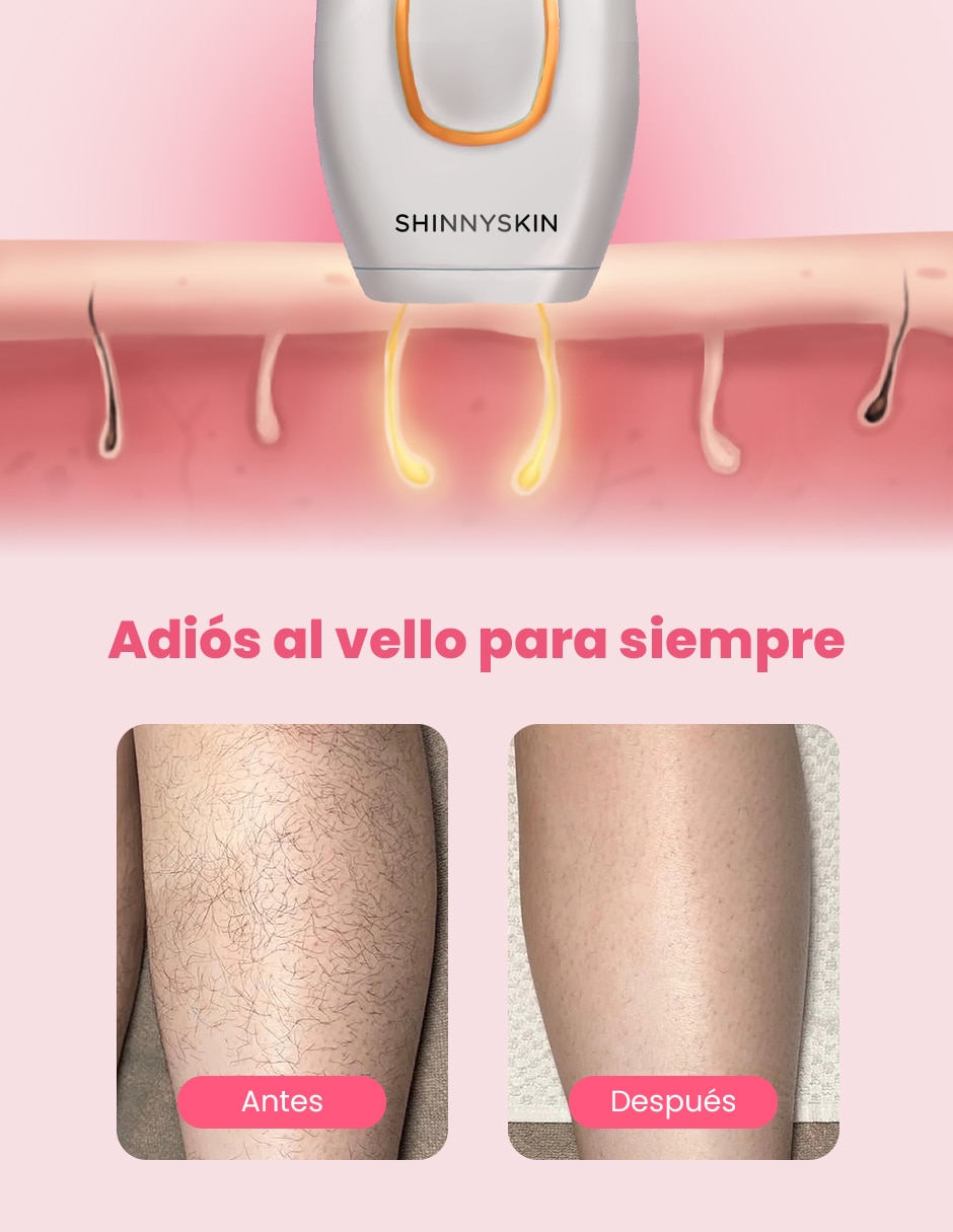 Kit depiladora IPL para rostro y cuerpo 2