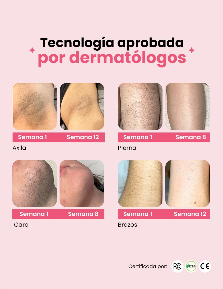 Kit depiladora IPL para rostro y cuerpo 7