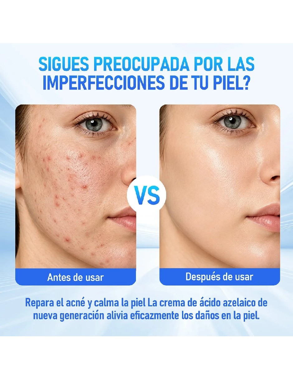 Set crema facial recomendada para desinflamar y relajar de día y noche para todo tipo de piel