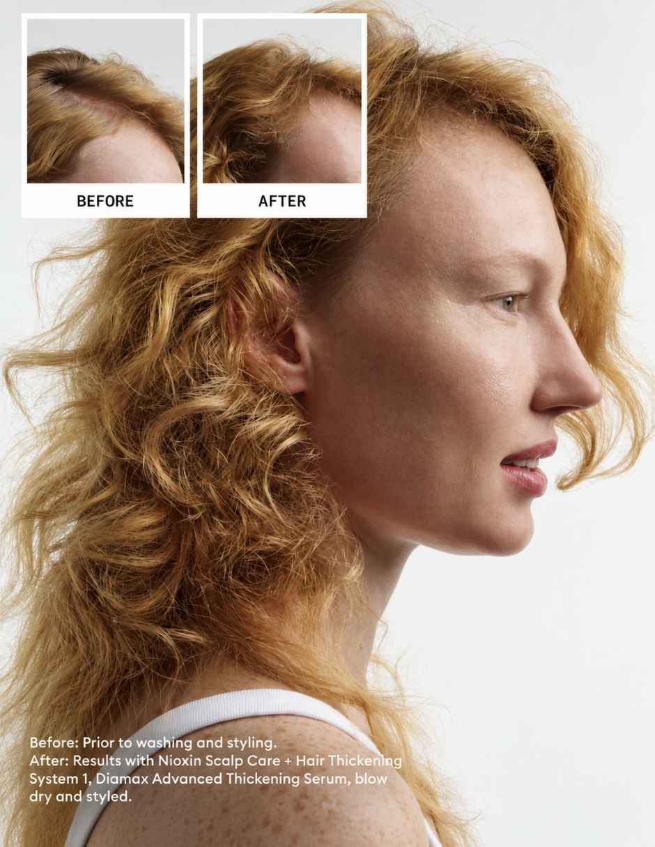 Acondicionador para cabello Acondicionador Sistema 1 para Cabello Natural con Debilitamiento Ligero 300 ml NIOXIN Nioxin 2