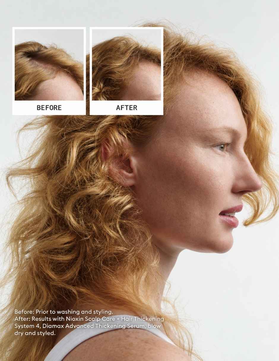Set capilar Nioxin Nioxin Kit Sistema 4 para Cabello Decolorado con Debilitamiento Avanzado 300 ml 3 Pasos para Todo tipo 3 piezas