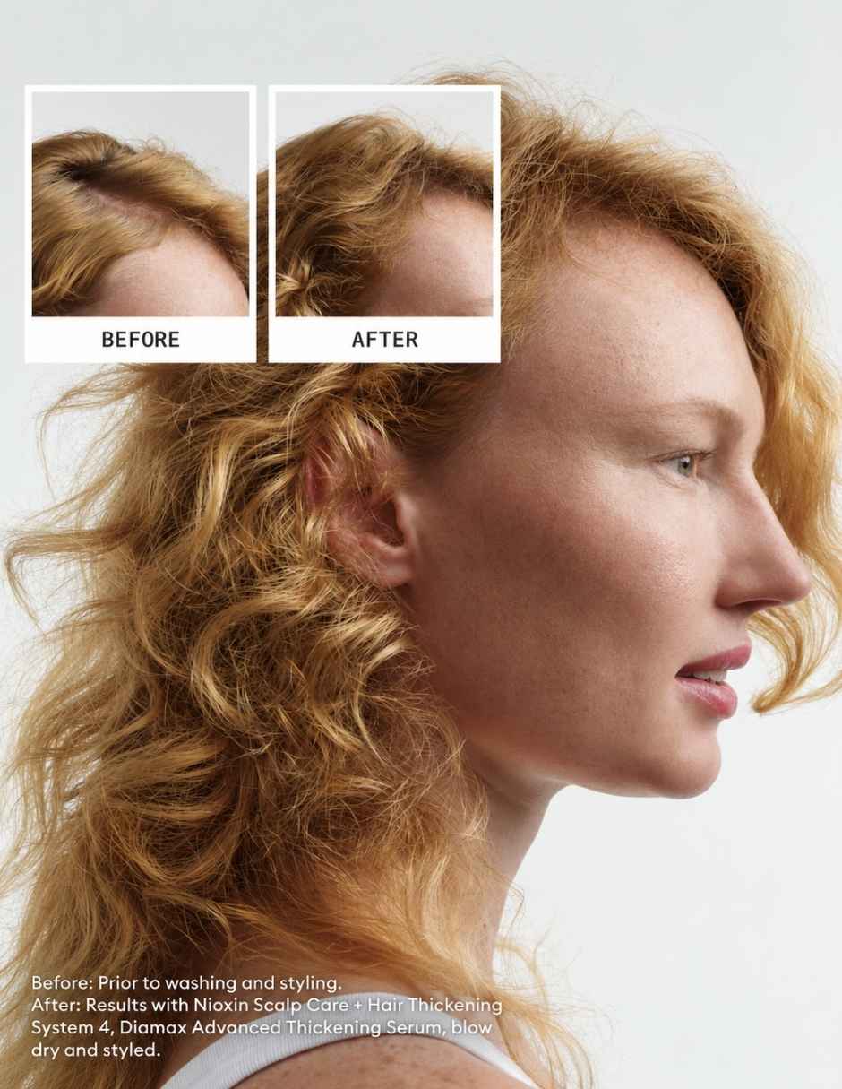 Set capilar Nioxin Nioxin Kit Sistema 4 para Cabello Decolorado con Debilitamiento Avanzado 150 ml 3 Pasos para Todo tipo 3 piezas