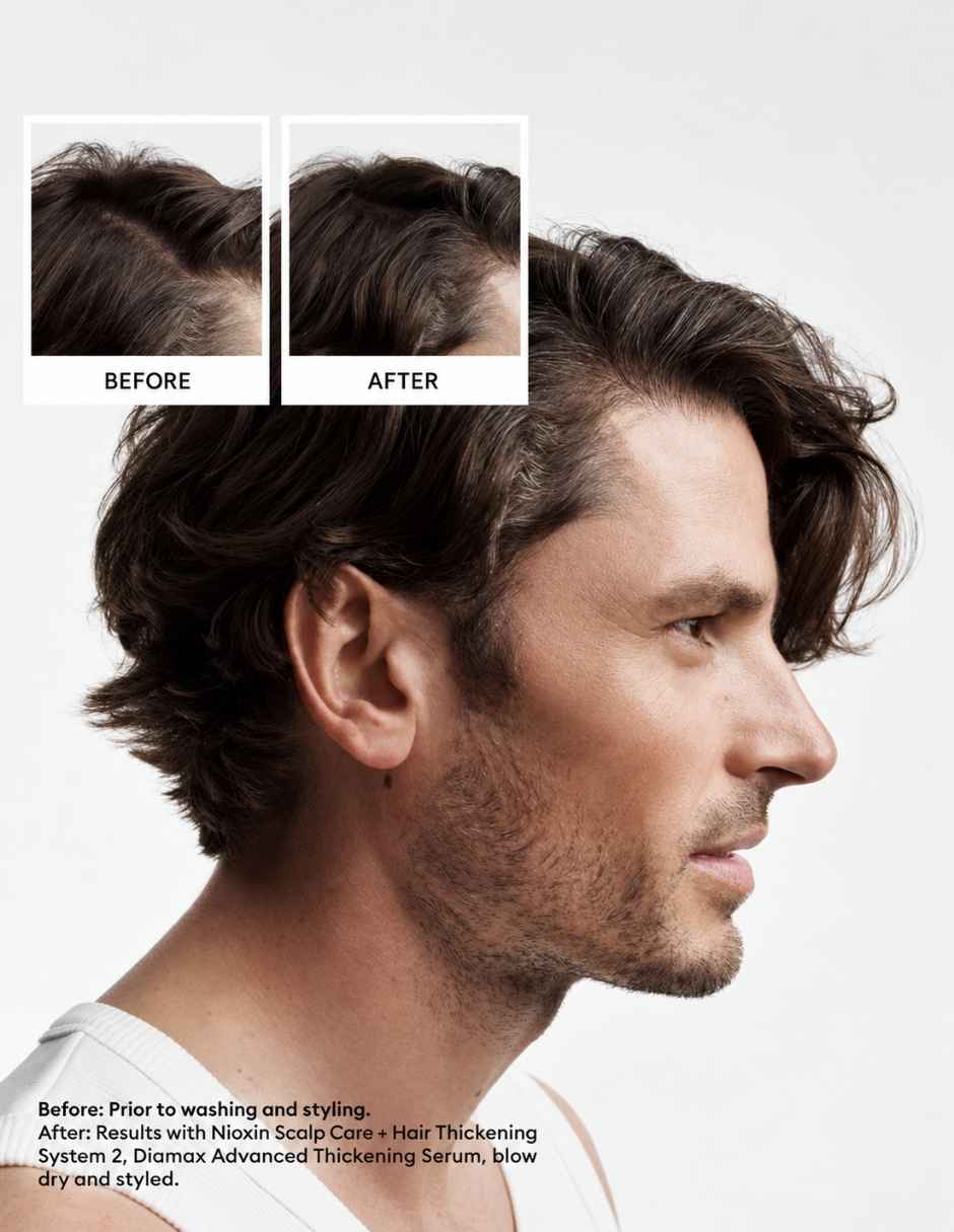 Set capilar Nioxin Nioxin Set Shampoo y Acondicionador Sistema 2 para Cabello Natural con Debilitamiento Avanzado 1000 para Todo tipo 2 piezas 2