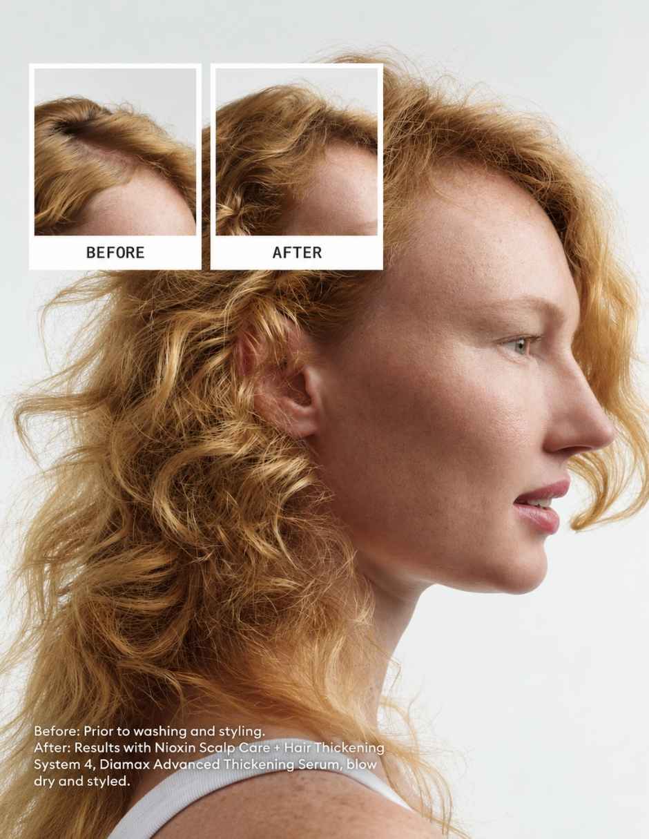 Set capilar Nioxin Nioxin Set Shampoo y Acondicionador Sistema 4 para Cabello Decolorad con Debilitamiento Avanzado 100 para Todo tipo 2 piezas