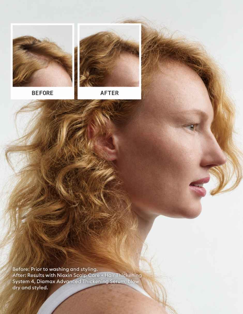 Set capilar Nioxin Nioxin Set Shampoo y Acondicionador Sistema 4 para Cabello Teñido con Debilitamiento Avanzado 300 para Todo tipo 2 piezas 2