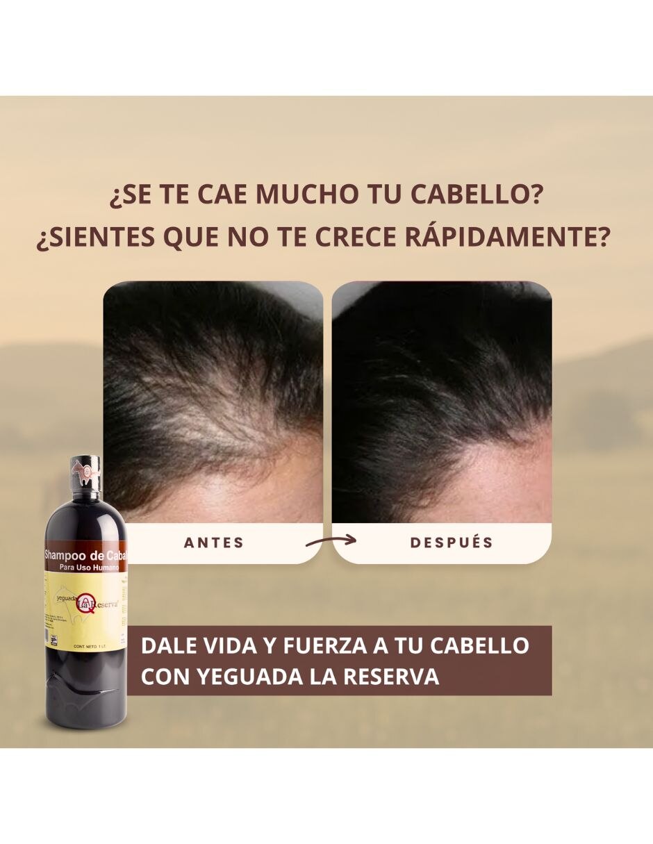 Set capilar Kit 2 Shampoo de Caballo Negro + 1 Colágeno Grande para Todo tipo 3 piezas 6
